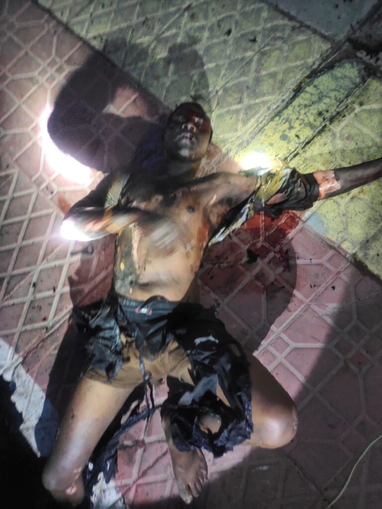 కరెంటు ఇంజన్ మీదికి దూకి వ్యక్తికి తీవ్ర గాయాలు…